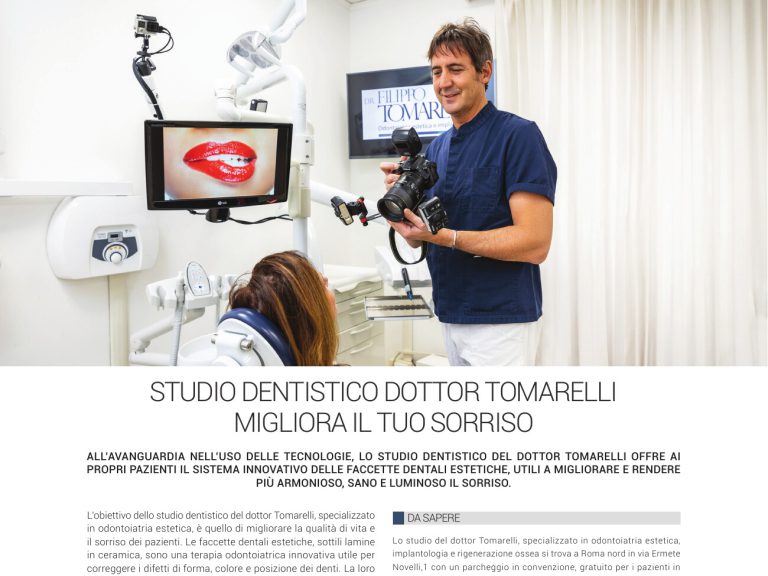 Be Different Magazine: Ago-Set – Faccette dentali (migliora il sorriso)