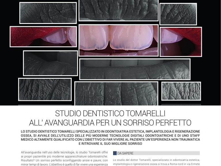 Be Different Magazine: Giu-Lug 24 – Avanguardia tecnologica per un sorriso perfetto
